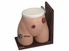 高級瘺管造口術(shù)護理模型